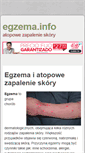 Mobile Screenshot of egzema.info