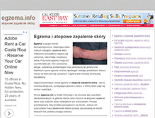 Tablet Screenshot of egzema.info
